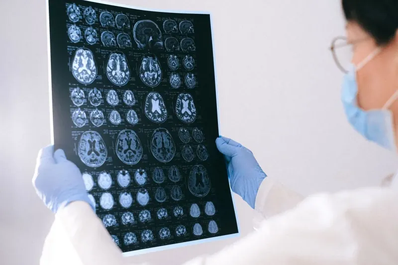 The FDA Approves The First Commercial Implanted Brain-computer Interface For Motor Function Restoration (Synchron Stentrode Or Neuralink N1). The FDA Approves The First Commercial Implanted Brain-computer Interface For Motor Function Restoration (Synchron Stentrode Or Neuralink N1).