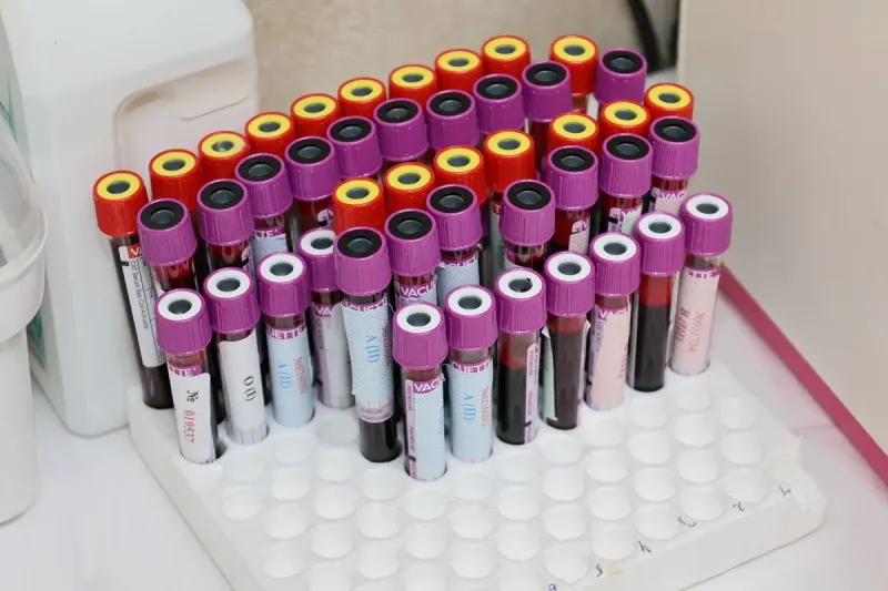 The First Senolytic Drug (Which Clears Aged 'zombie Cells') Is Expected To Gain Regulatory Approval For An Age-related Indication Or Reach Phase 3 By 2030, As More Than 30 Senolytic Clinical Trials Mature Into Results. The First Senolytic Drug (Which Clears Aged 'zombie Cells') Is Expected To Gain Regulatory Approval For An Age-related Indication Or Reach Phase 3 By 2030, As More Than 30 Senolytic Clinical Trials Mature Into Results.
